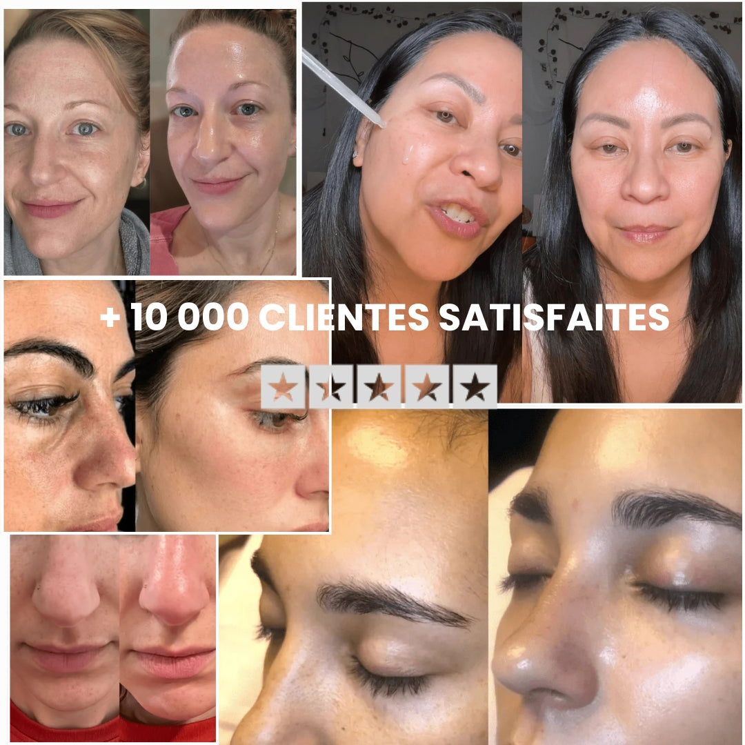 Peel Shotp Coréen – Transforme ta peau, élimine les points noirs