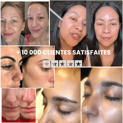 Peel Shotp Coréen – Transforme ta peau, élimine les points noirs