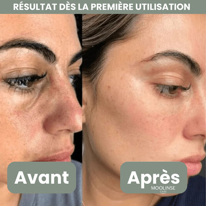 Peel Shotp Coréen – Transforme ta peau, élimine les points noirs