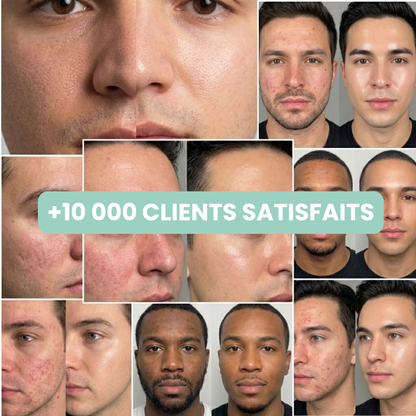 Peel Shotp Coréen – Transforme ta peau, élimine les points noirs