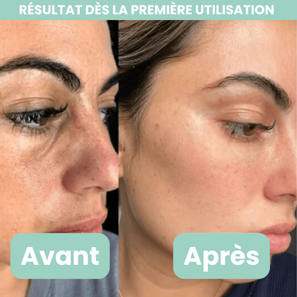Peel Shotp Coréen – Transforme ta peau, élimine les points noirs
