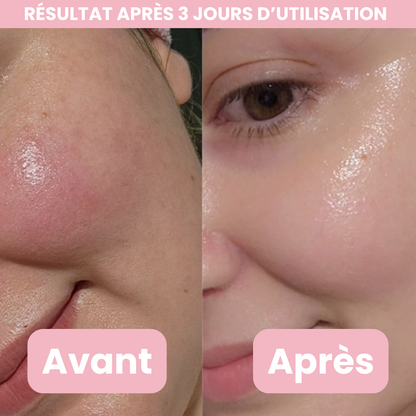 Moolinse - Crème Medicube au collagène rose et PDRN