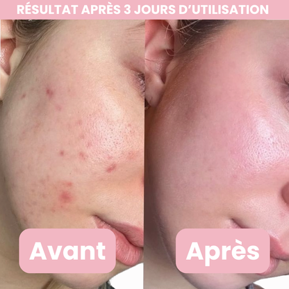 Moolinse - Crème Medicube au collagène rose et PDRN